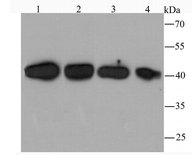 TXNIP Antibody in Western Blot (WB)