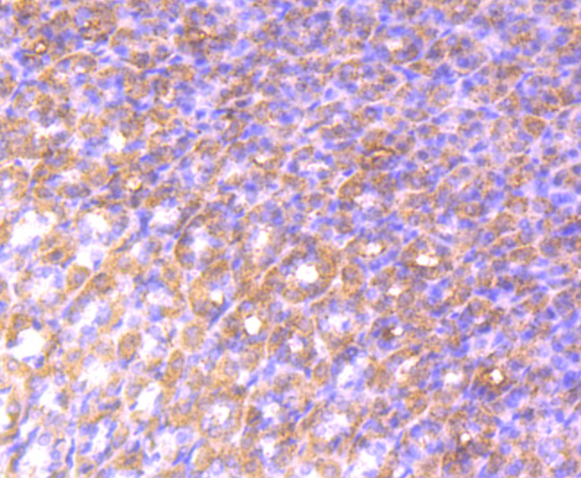 Alix Antibody in Immunohistochemistry (Paraffin) (IHC (P))