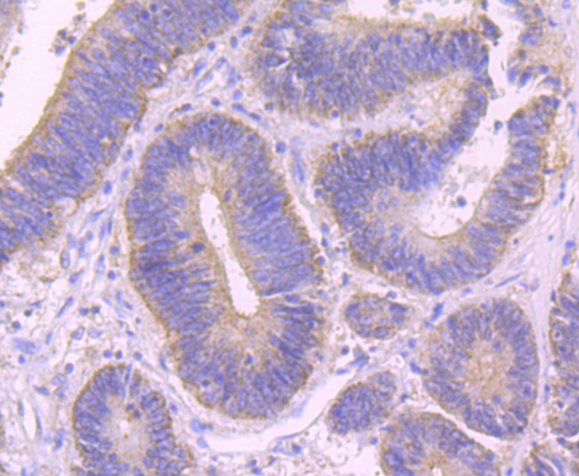 Alix Antibody in Immunohistochemistry (Paraffin) (IHC (P))