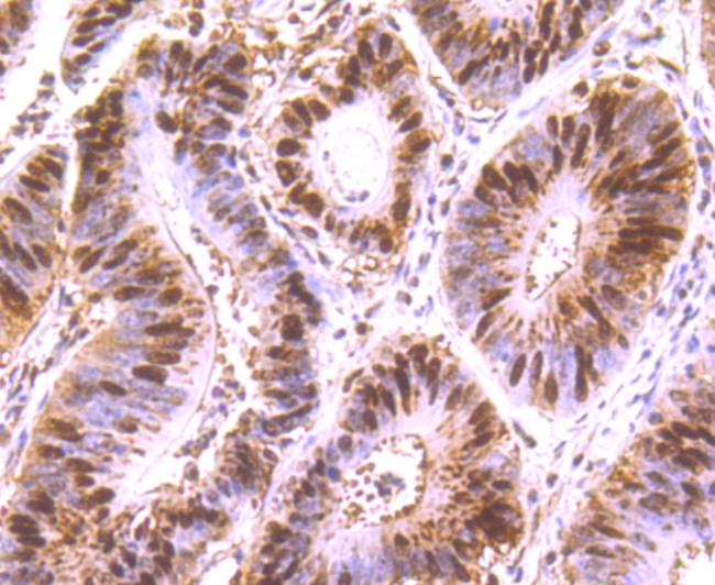 HuR Antibody in Immunohistochemistry (Paraffin) (IHC (P))