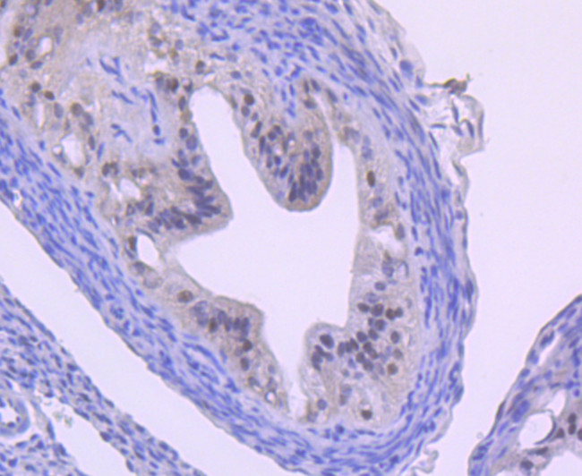 Cullin 1 Antibody in Immunohistochemistry (Paraffin) (IHC (P))