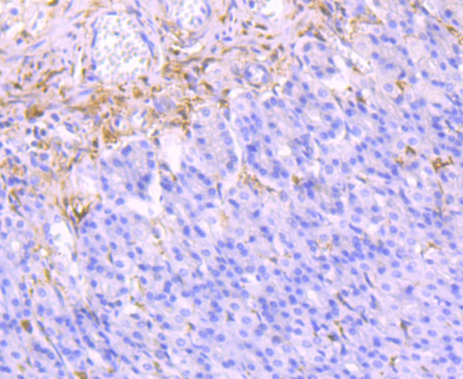 Galectin 1 Antibody in Immunohistochemistry (Paraffin) (IHC (P))