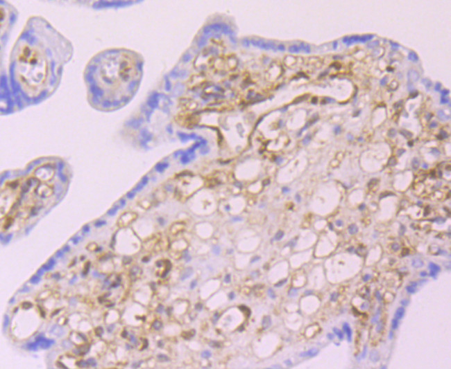 Galectin 1 Antibody in Immunohistochemistry (Paraffin) (IHC (P))