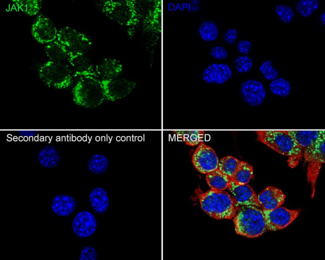 JAK1 Antibody in Immunocytochemistry (ICC/IF)