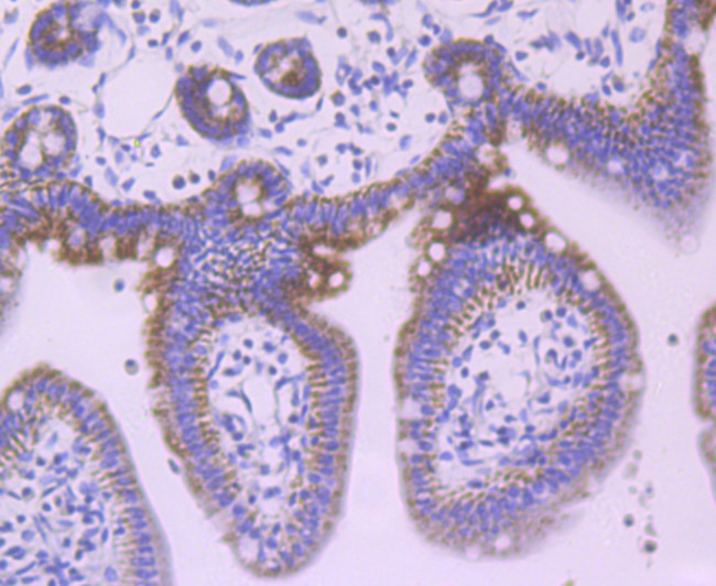 JAK1 Antibody in Immunohistochemistry (Paraffin) (IHC (P))