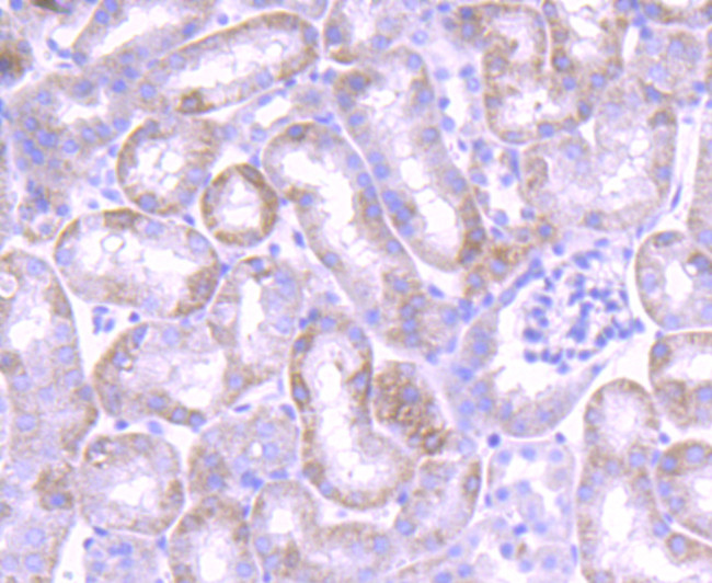 JAK1 Antibody in Immunohistochemistry (Paraffin) (IHC (P))