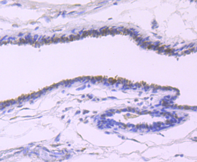 TFF1 Antibody in Immunohistochemistry (Paraffin) (IHC (P))