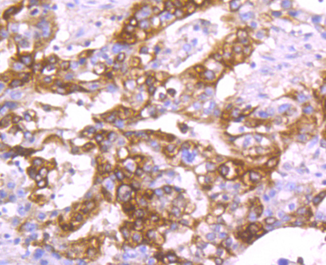 TFF1 Antibody in Immunohistochemistry (Paraffin) (IHC (P))