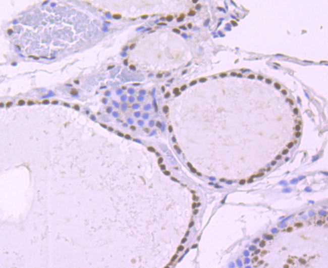 NRF1 Antibody in Immunohistochemistry (Paraffin) (IHC (P))