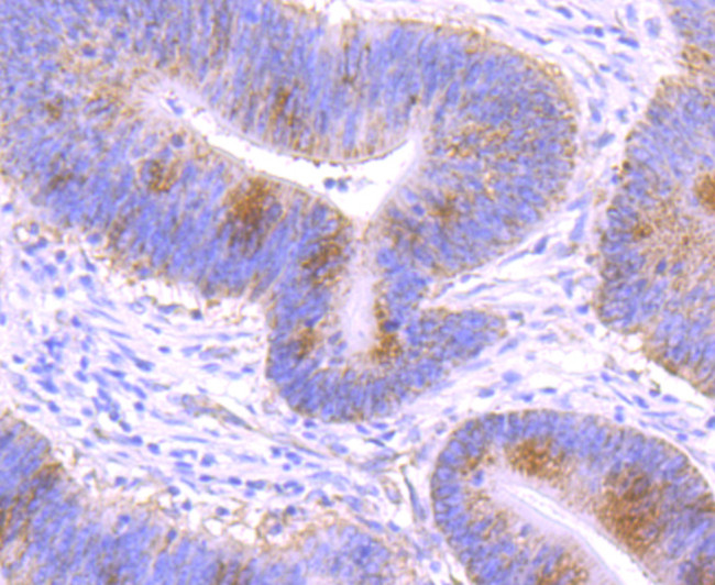 GCLM Antibody in Immunohistochemistry (Paraffin) (IHC (P))