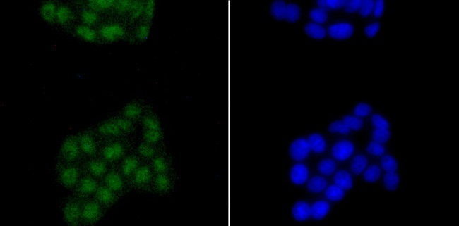 SATB2 Antibody in Immunocytochemistry (ICC/IF)