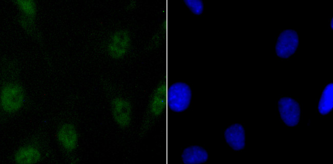 SATB2 Antibody in Immunocytochemistry (ICC/IF)