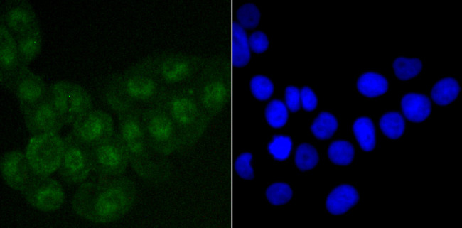 SATB2 Antibody in Immunocytochemistry (ICC/IF)