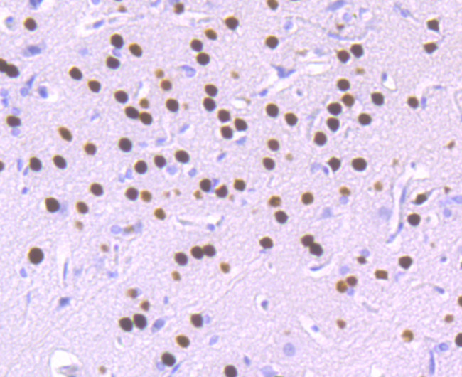 SATB2 Antibody in Immunohistochemistry (Paraffin) (IHC (P))