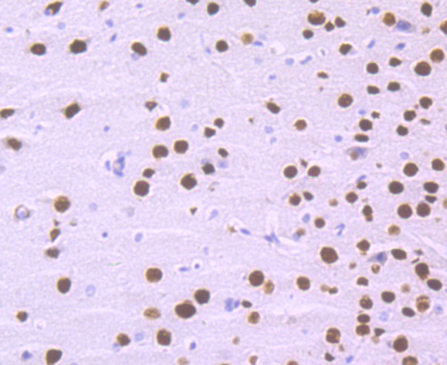 SATB2 Antibody in Immunohistochemistry (Paraffin) (IHC (P))