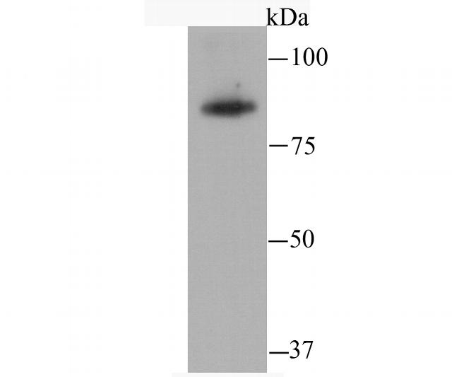 SATB2 Antibody in Western Blot (WB)