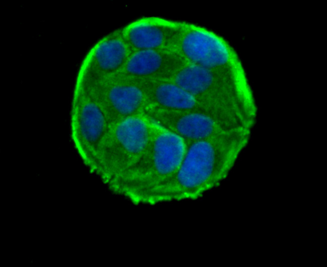 RAD51 Antibody in Immunocytochemistry (ICC/IF)