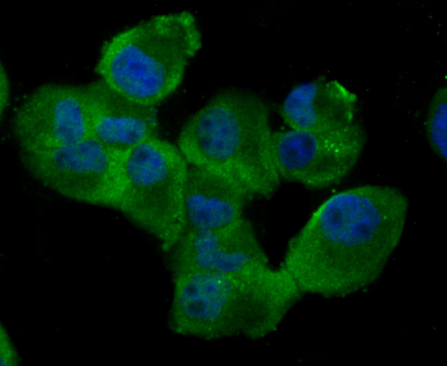 RAD51 Antibody in Immunocytochemistry (ICC/IF)