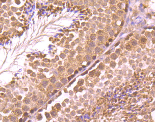 RAD51 Antibody in Immunohistochemistry (Paraffin) (IHC (P))