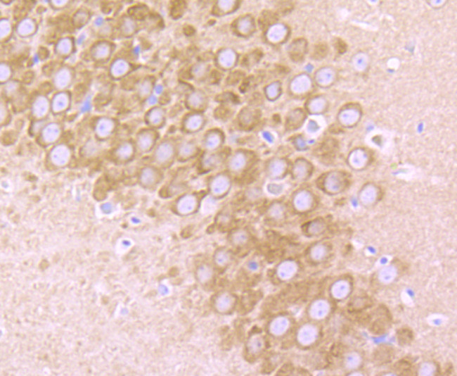 GluR2 Antibody in Immunohistochemistry (Paraffin) (IHC (P))