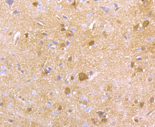 HPRT1 Antibody in Immunohistochemistry (Paraffin) (IHC (P))