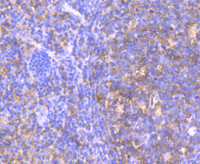 HPRT1 Antibody in Immunohistochemistry (Paraffin) (IHC (P))