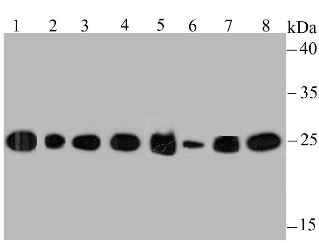 HPRT1 Antibody in Western Blot (WB)