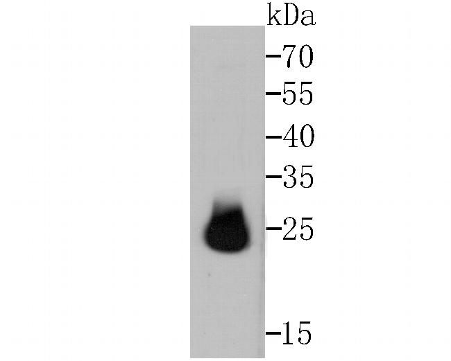 HPRT1 Antibody in Western Blot (WB)