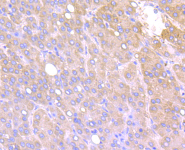 IFITM3 Antibody in Immunohistochemistry (Paraffin) (IHC (P))