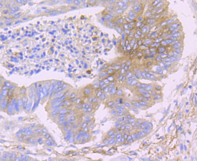 IFITM3 Antibody in Immunohistochemistry (Paraffin) (IHC (P))