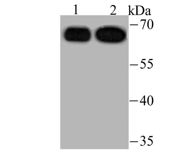 USP22 Antibody in Western Blot (WB)