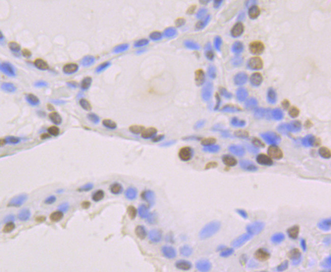 Histone Macro-H2A.1 Antibody in Immunohistochemistry (Paraffin) (IHC (P))