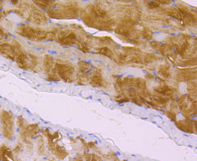 Zyxin Antibody in Immunohistochemistry (Paraffin) (IHC (P))