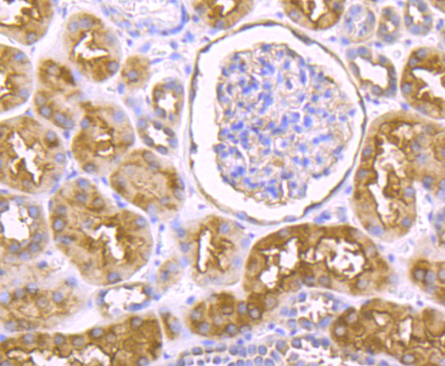 IKK epsilon Antibody in Immunohistochemistry (Paraffin) (IHC (P))