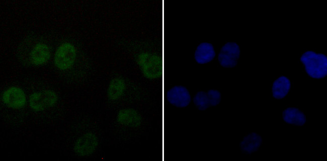 DDB1 Antibody in Immunocytochemistry (ICC/IF)