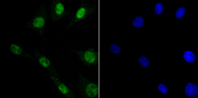 DDB1 Antibody in Immunocytochemistry (ICC/IF)