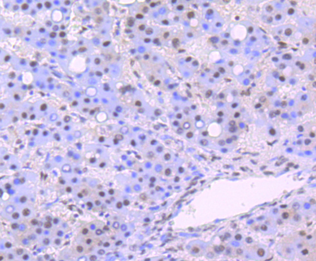 DDB1 Antibody in Immunohistochemistry (Paraffin) (IHC (P))