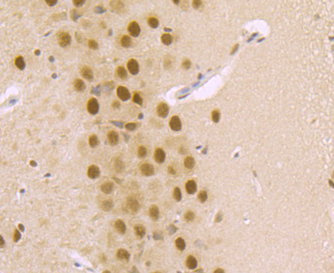 DDB1 Antibody in Immunohistochemistry (Paraffin) (IHC (P))