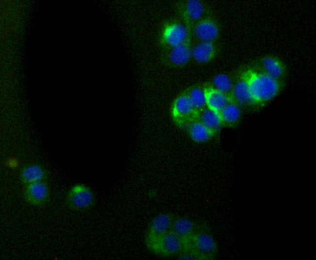 alpha Internexin Antibody in Immunocytochemistry (ICC/IF)