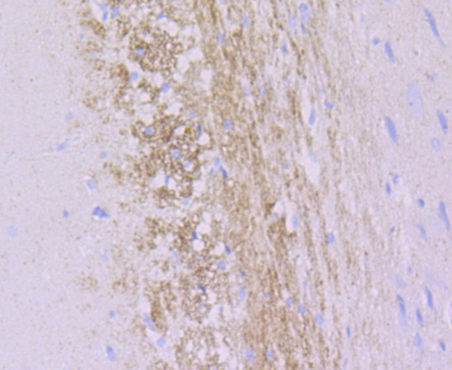 alpha Internexin Antibody in Immunohistochemistry (Paraffin) (IHC (P))