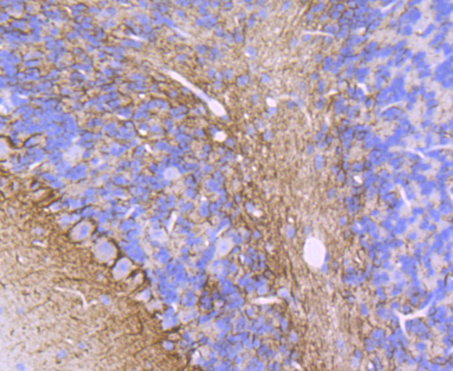 alpha Internexin Antibody in Immunohistochemistry (Paraffin) (IHC (P))