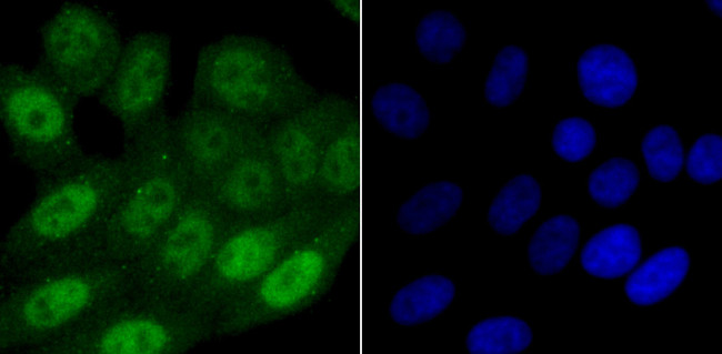 SAMHD1 Antibody in Immunocytochemistry (ICC/IF)