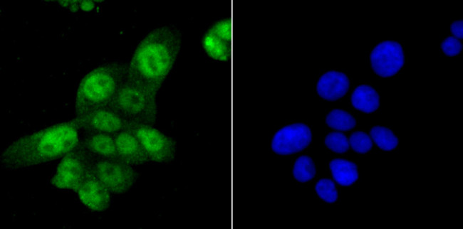 SAMHD1 Antibody in Immunocytochemistry (ICC/IF)