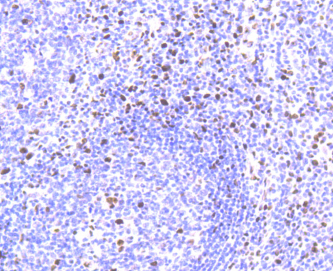 SAMHD1 Antibody in Immunohistochemistry (Paraffin) (IHC (P))