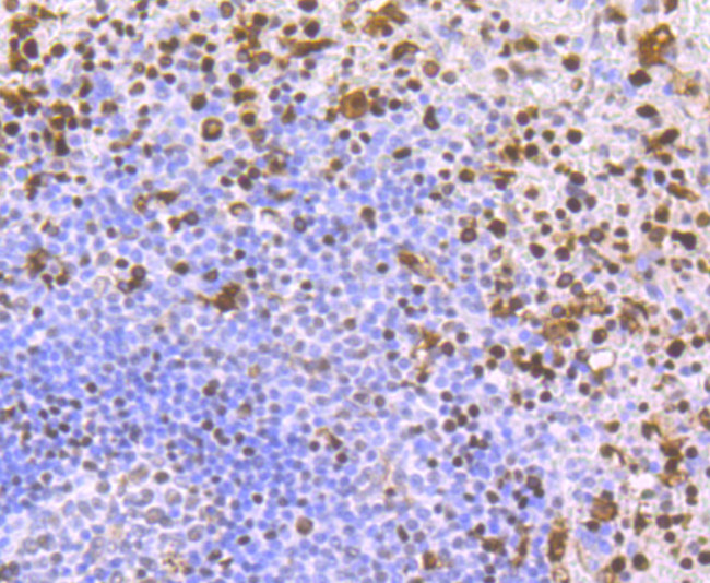 SAMHD1 Antibody in Immunohistochemistry (Paraffin) (IHC (P))