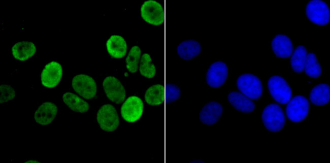 H3K14ac Antibody in Immunocytochemistry (ICC/IF)