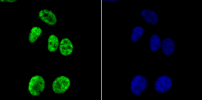 H3K14ac Antibody in Immunocytochemistry (ICC/IF)