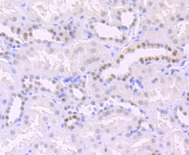 H3K14ac Antibody in Immunohistochemistry (Paraffin) (IHC (P))