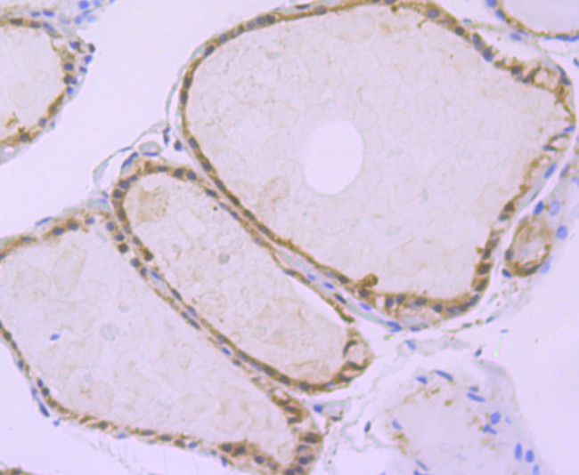 ATG3 Antibody in Immunohistochemistry (Paraffin) (IHC (P))