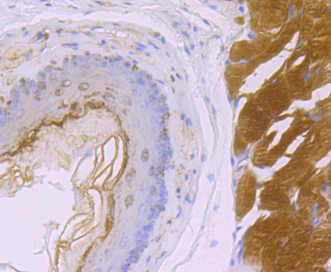 SDHB Antibody in Immunohistochemistry (Paraffin) (IHC (P))